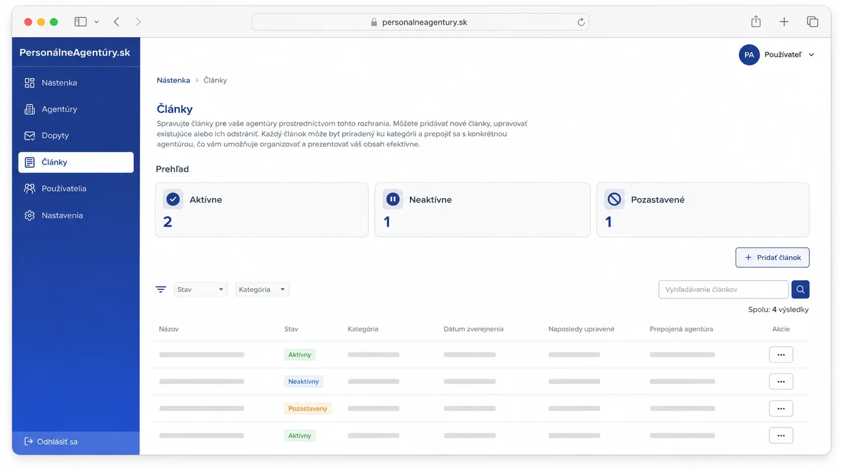 articles — write, edit, publish or hide
